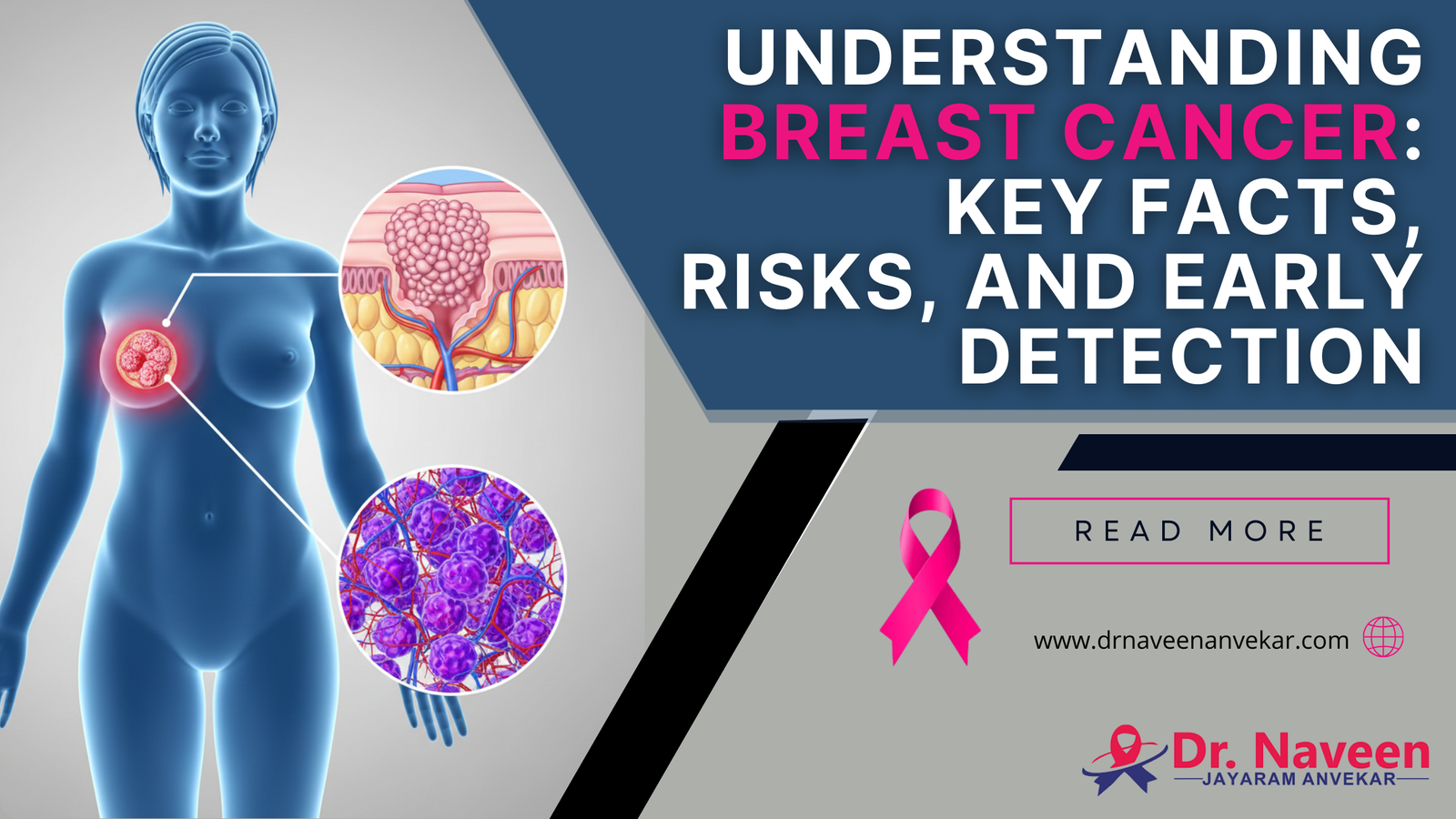 Understanding Breast Cancer: Key Facts, Risks, and Early Detection